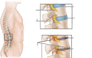 bolovi u mišićima u ruci ili zglobu liječenje artroza i hrana