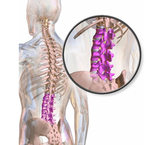 bol u zglobovima i mišićima donjeg dijela leđa