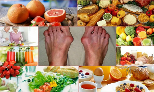 hrane i liječenje osteoartritisa