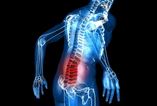 Simptomi osteohondroze