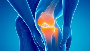 artroza koljena