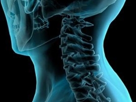 metode za dijagnozu cervikalne osteohondroze