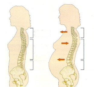 osteohondroza tijekom trudnoće